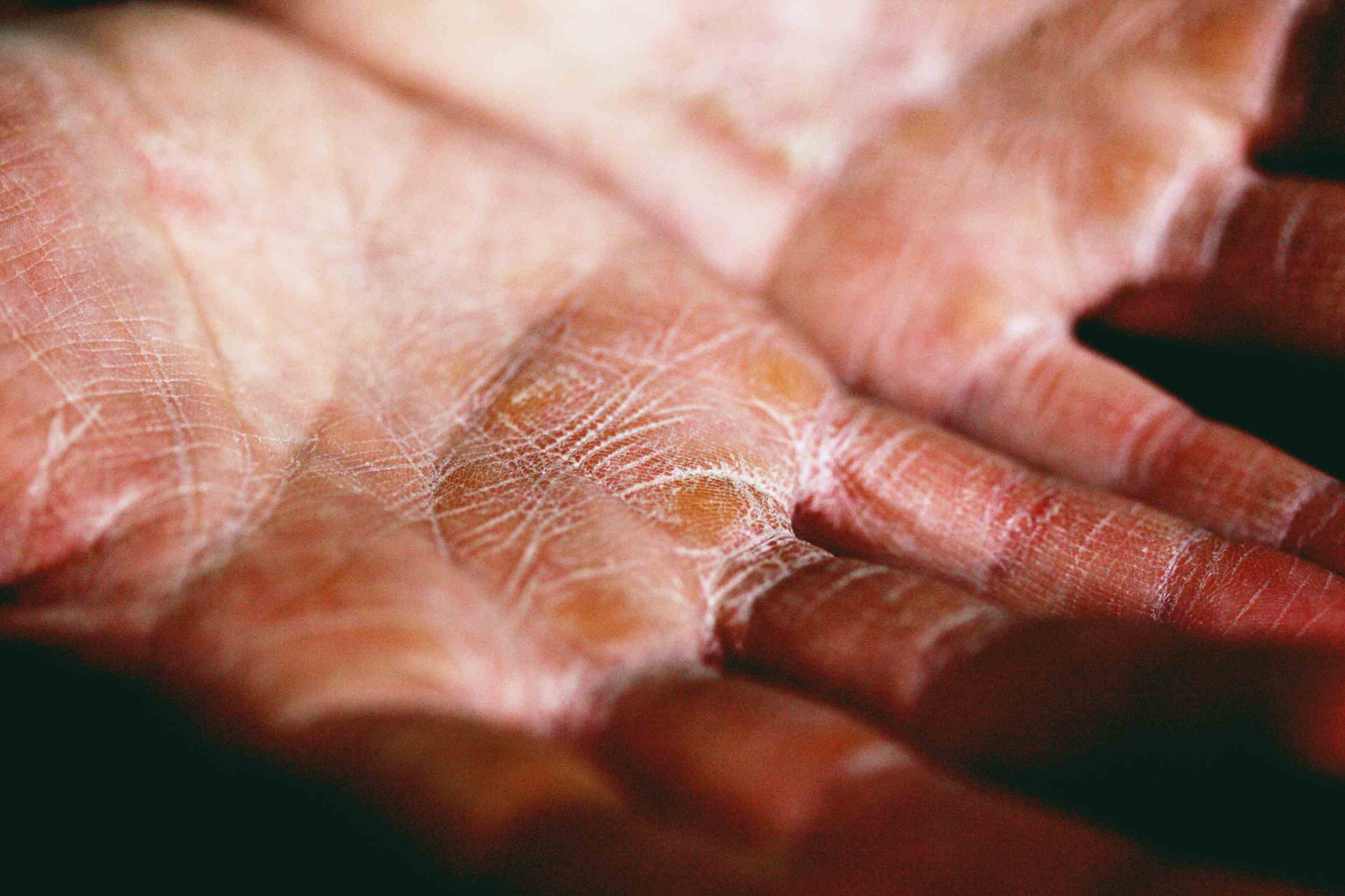 An elder's hand with full of wrinkles and fine lines