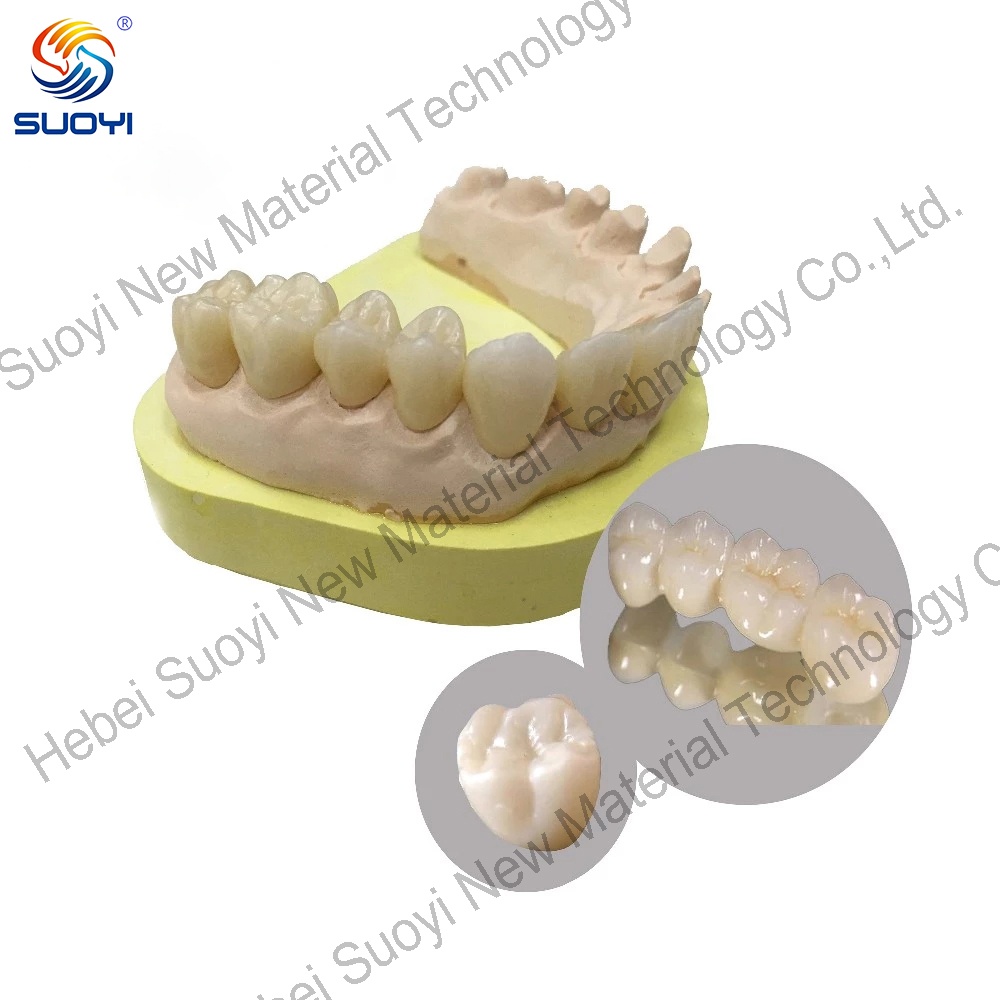 Quali fattori devono considerare i professionisti del settore dentale quando valutano i diversi fornitori di blocchi ceramici di zirconia dentale da 98 mm per le loro cliniche o laboratori?